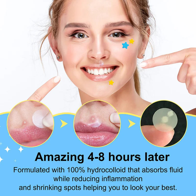 Acne Pimple Patches