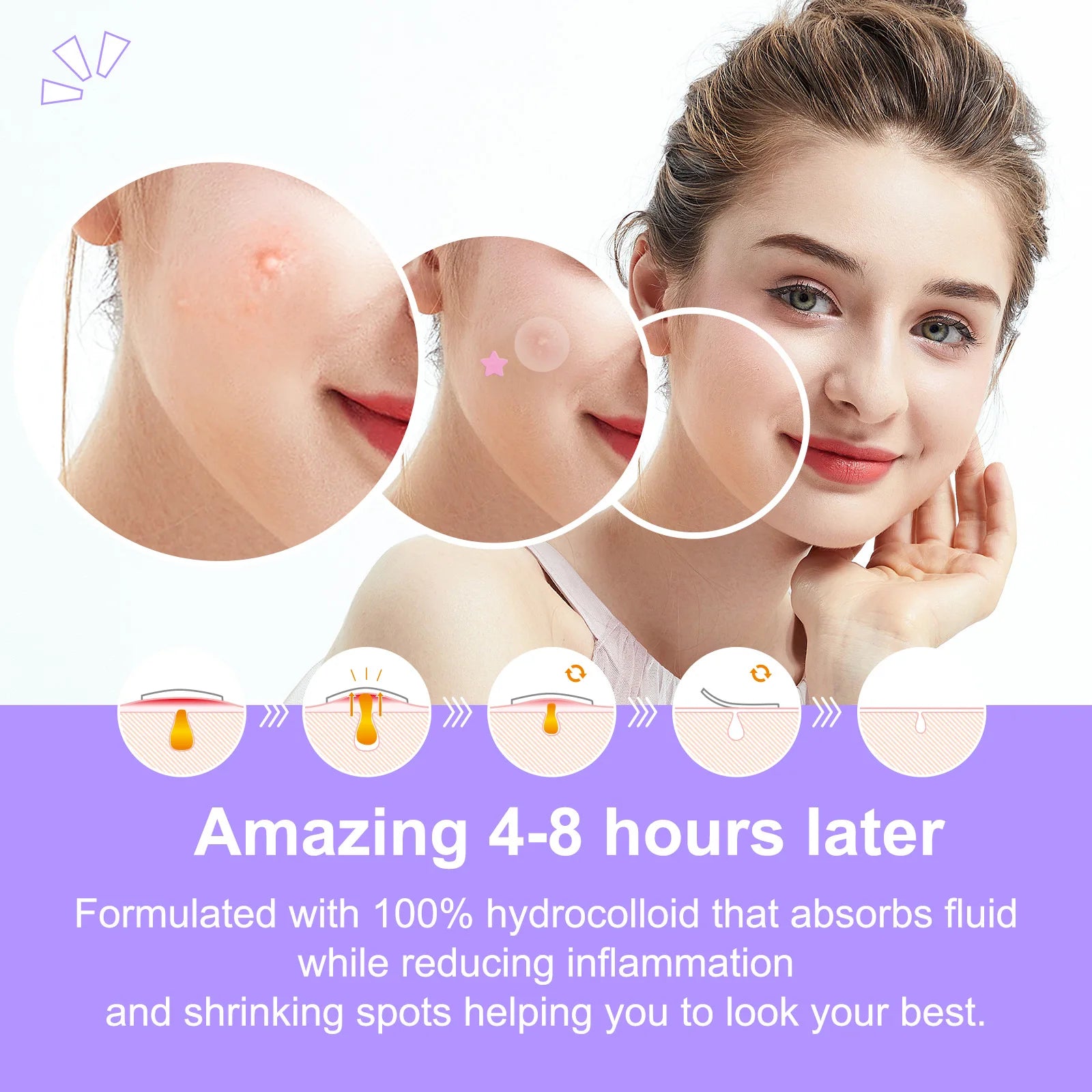Acne Pimple Patches