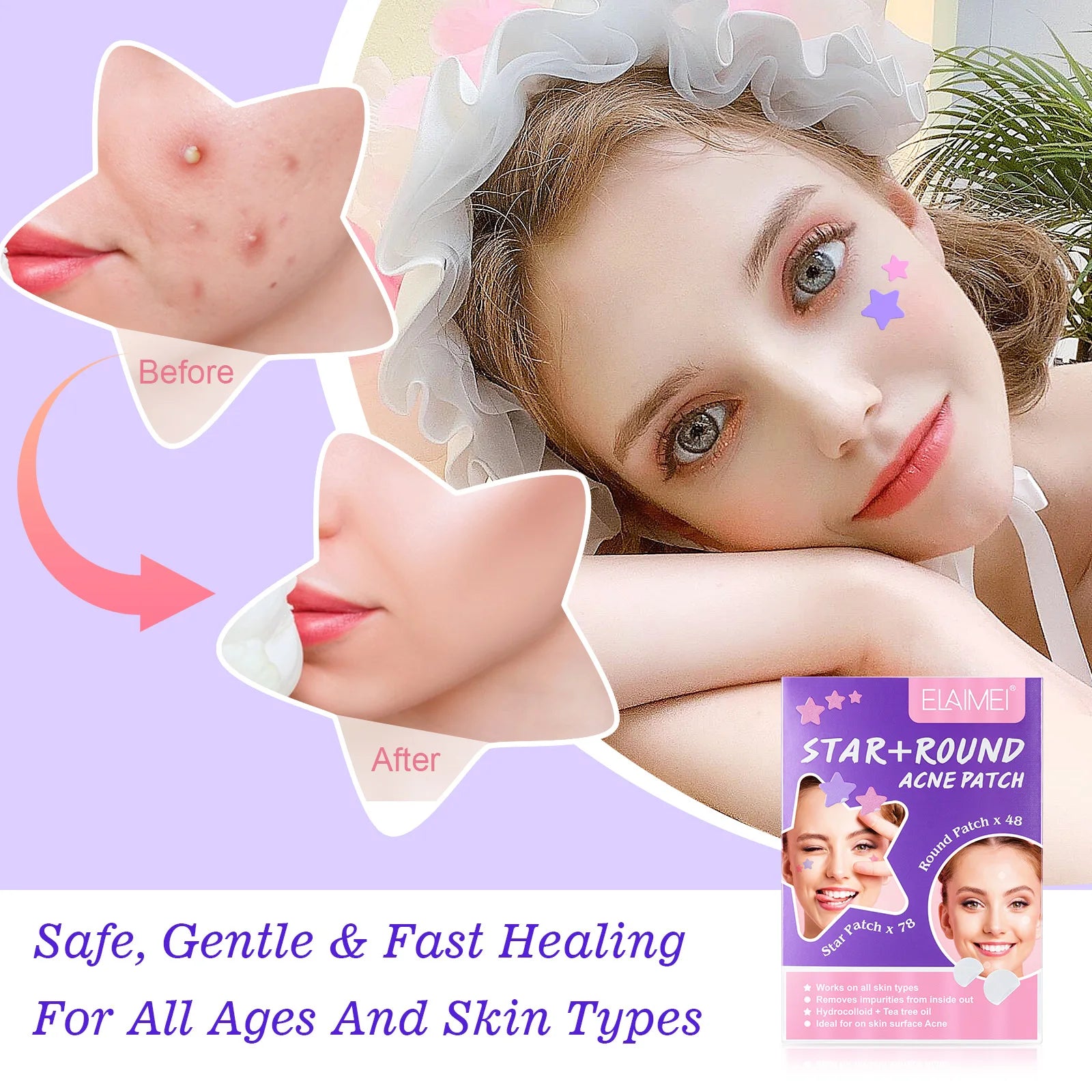 Acne Pimple Patches